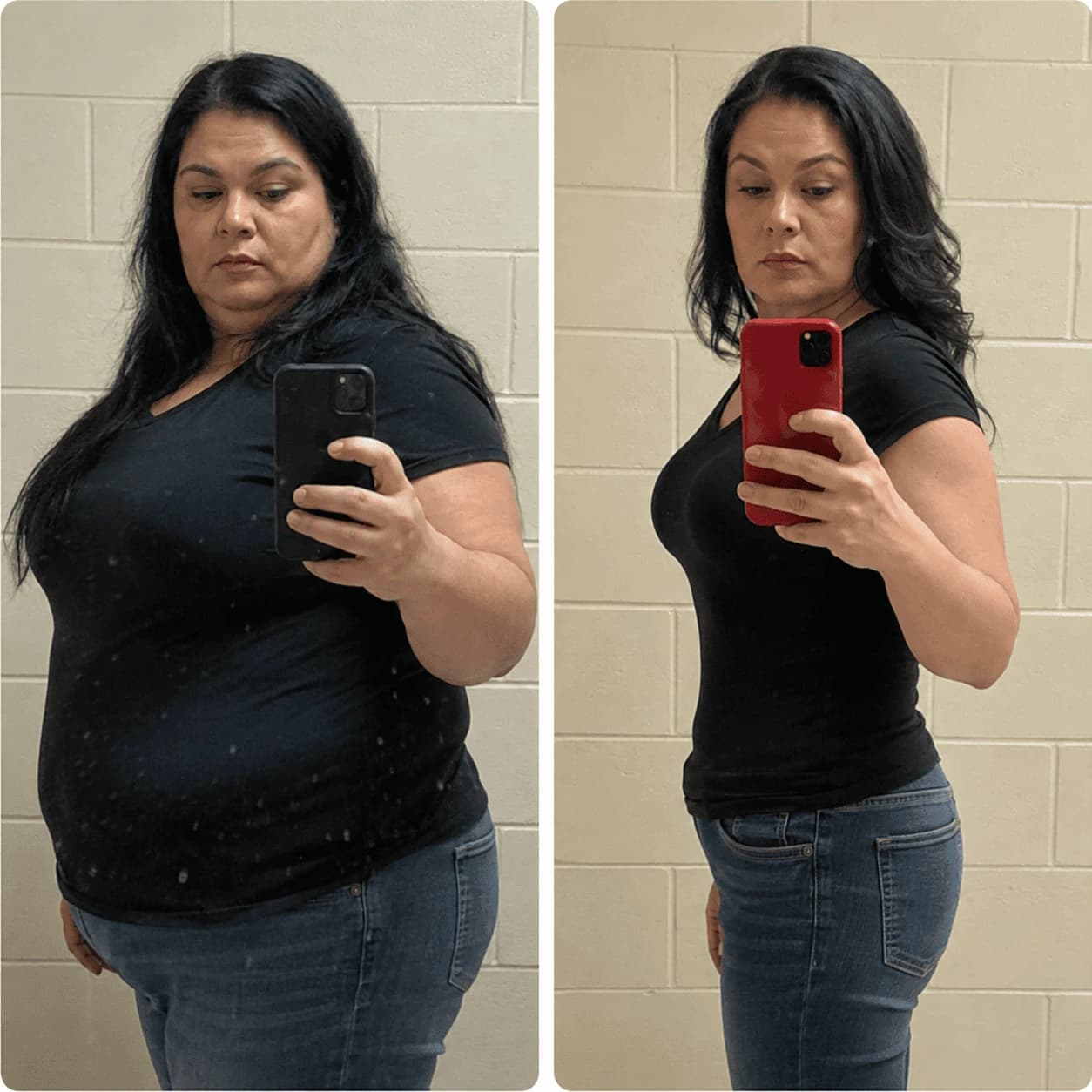 Alexandra, PPRX patient — before and after losing 29.5 kg in 12 months